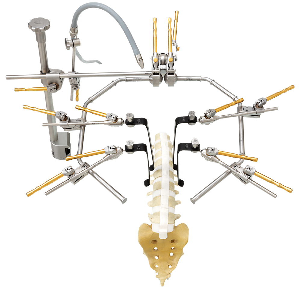 condor-goldline-anteriorer-posteriorer-zugang-lws-wirbelsaeulenchirurgie