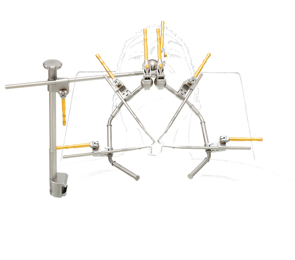 Minisystem Mivat